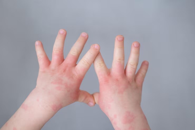 bahaya kapur barus, kapur barus untuk anak, efek samping kapur barus, racun naftalena, ibu muda dan kesehatan rumah, pengharum pakaian alami, tips aman kapur barus, gangguan saraf akibat kapur barus, kejang karena kapur barus, kapur barus dan anak-anak